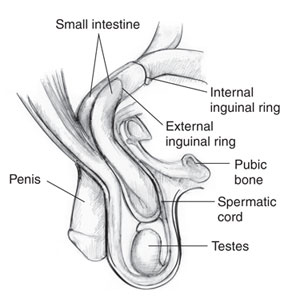 HERNIAS INGUINALES PEDIATRIA PDF DOWNLOAD